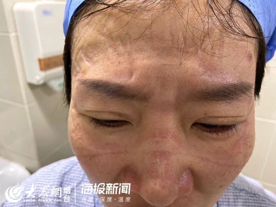 这就是山东丨医者手记：深深勒痕是我们的“战书”