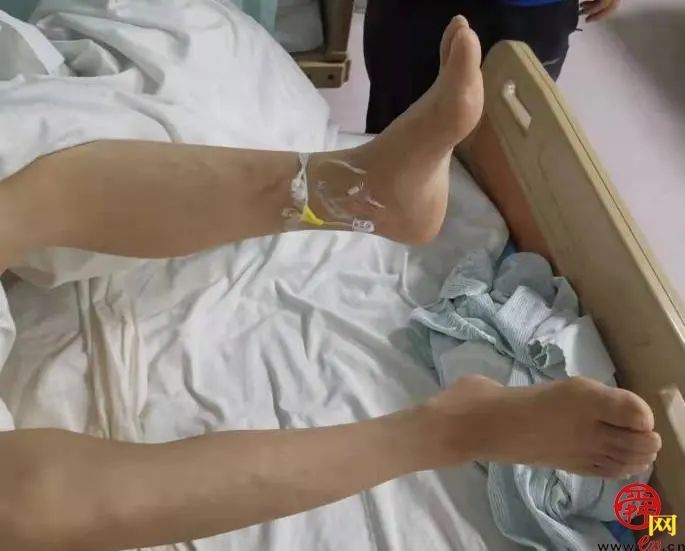 生死时速--溶栓取栓桥接治疗急性卒中