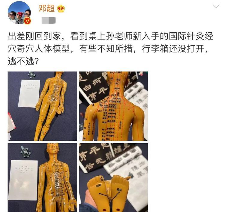 邓超孙俪爆笑日常 看见针灸模型有些不知所措