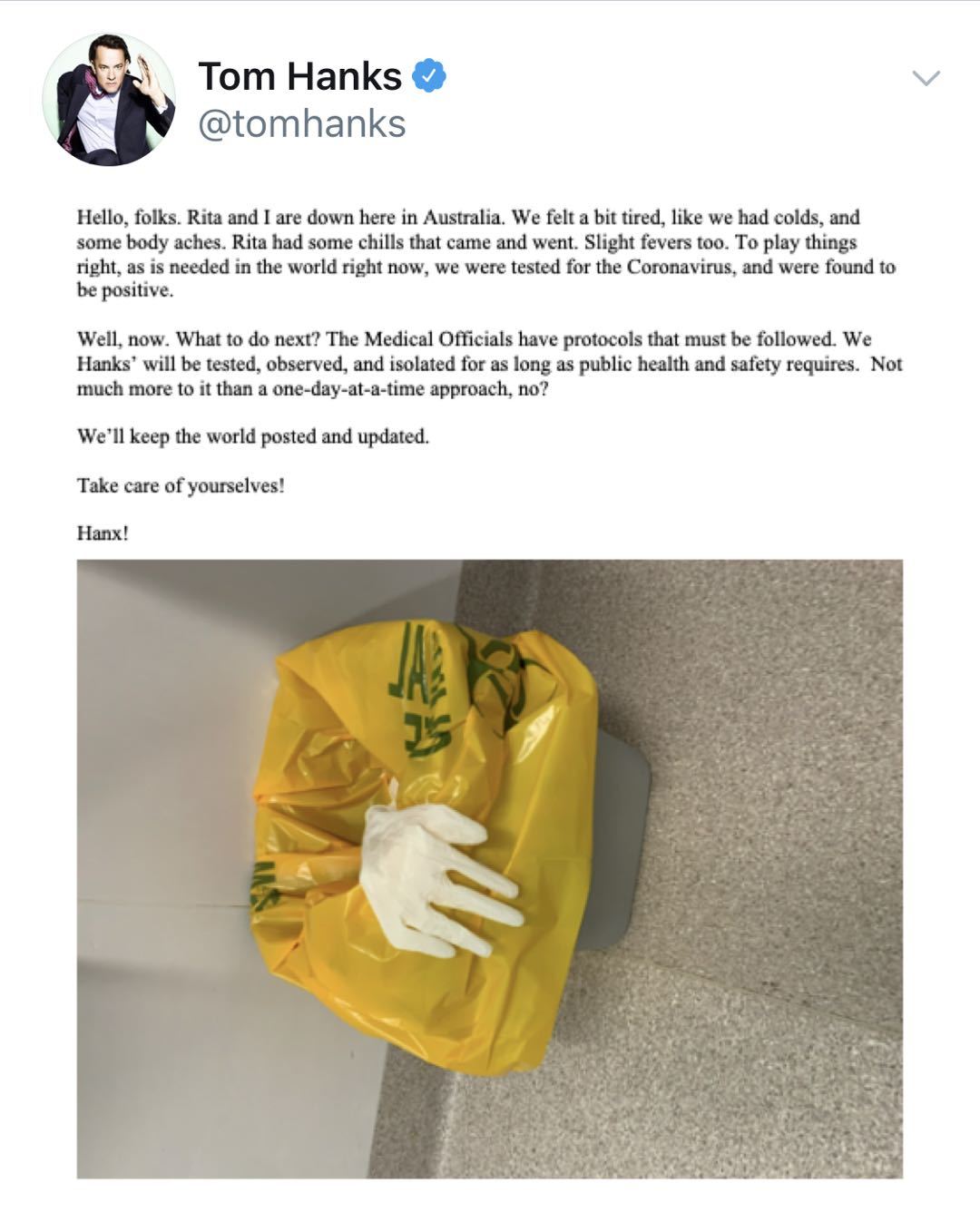 汤姆汉克斯确诊!汤姆汉克斯儿子发声说了什么?他是如何确诊的?