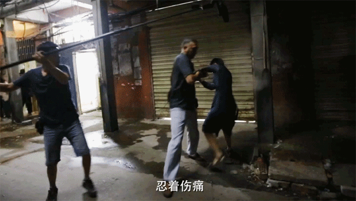 桂纶镁拍戏不慎“深二度烧伤”，手臂冒泡强忍疼痛不停工