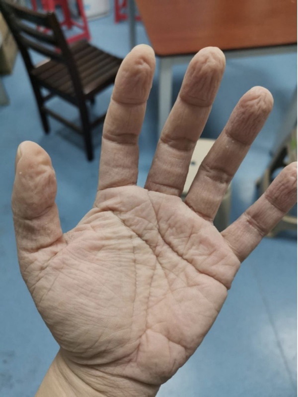 全民阻击丨心疼！没想到前方的你是这样的