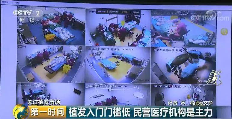 中国脱发人群超2.5亿 植发能否挽救“头顶大事”？