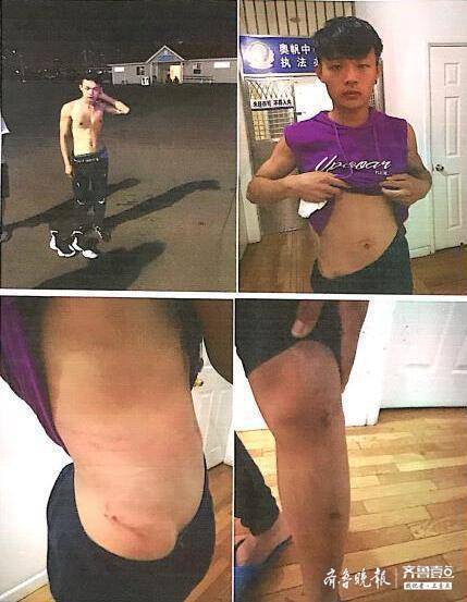 山管学子青岛海边勇救落水者，身上多处被划伤