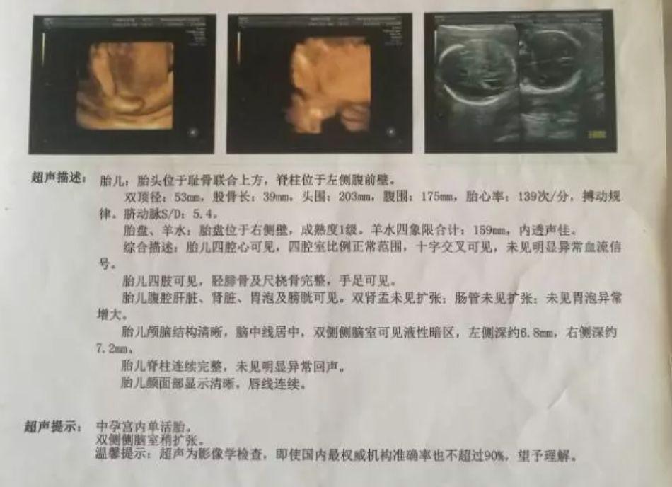 两次产检没问题，孩子出生后吓到了！现在只能爬行...