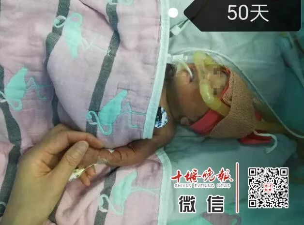 妈妈怀孕6个月产下巴掌大女婴！医生拍下14张照片，张张让人落泪……