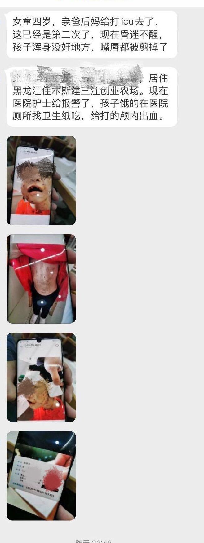 令人发指!被虐打女童有生命危险仍昏迷 屡遭拳殴开水烫拽发撞墙 