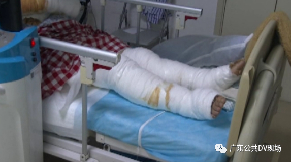 “一阵光从外面进来！”女子在家中被雷击倒严重烧伤，防盗门都弹飞了！