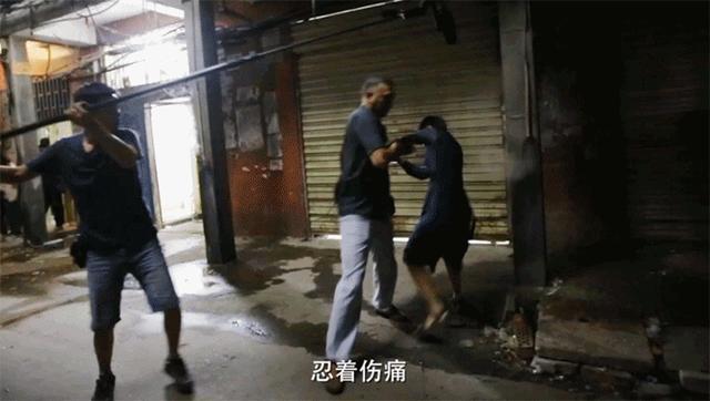 桂纶镁拍戏不慎“深二度烧伤”，手臂冒泡强忍疼痛不停工