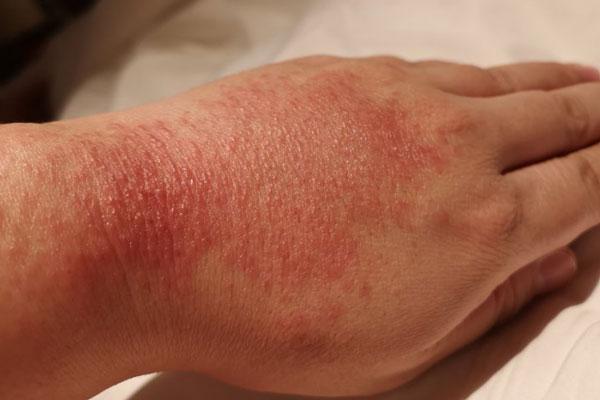 【湖北救援日记】病人的笑颜是我最大的动力